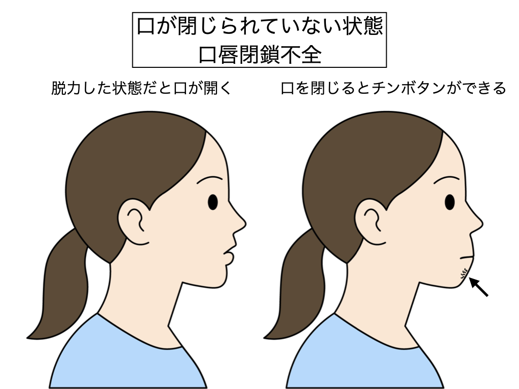 第13回：なぜフルパッシブ矯正はドリコのために生まれたのか | 白石